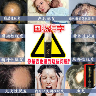 快速防脱发增发密发生发液掉头发增长剂脂溢性育少白头白发变黑发